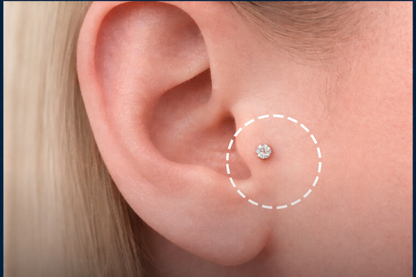 TRAGUS